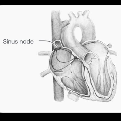 Nó Sinusal e Despolarização Atrial: Entendendo o Ritmo Cardíaco
