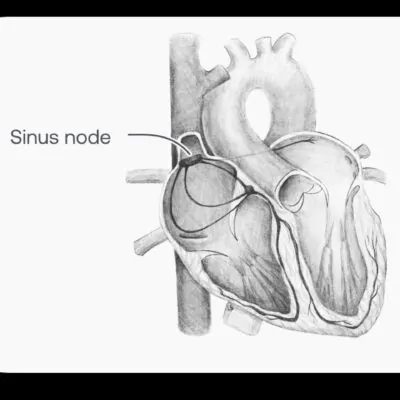 Nó Sinusal e Despolarização Atrial: Entendendo o Ritmo Cardíaco
