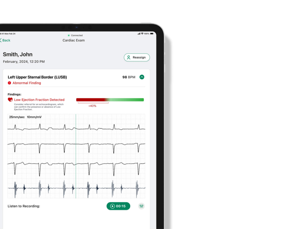 Eko CORE 500™: Estetoscópio Digital com Inteligência Artificial